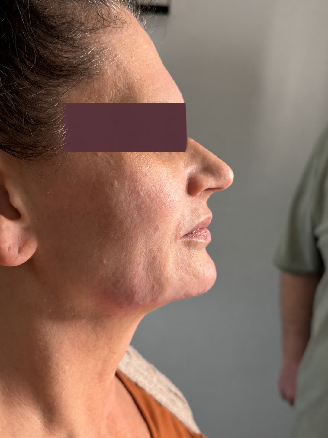 Praxisaufnahme mit abgedeckter Augenpartie